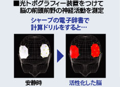 �ʐ^�@���g�|�O���t�B�[���u�����ā@�]�̑O���O��̐_�o�����𑪒�